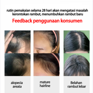 Scalp Essence Night Use - 3